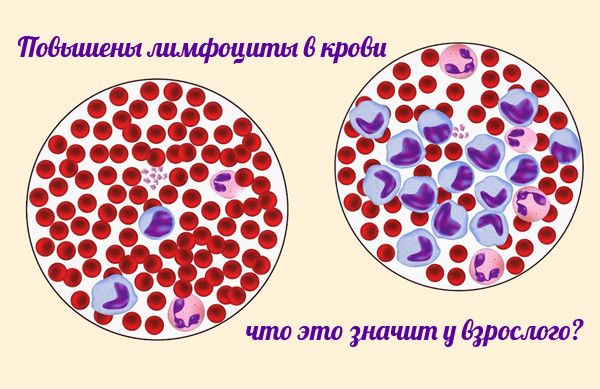 Анализ крови расшифровка лимфоциты выше нормы