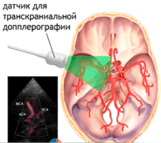 issledovanie-sosudov-5-e1502700459406.png