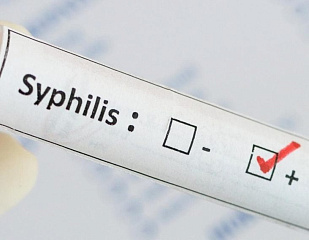 Доклад: Сифилис. Симптомы сифилиса. Лечение сифилиса