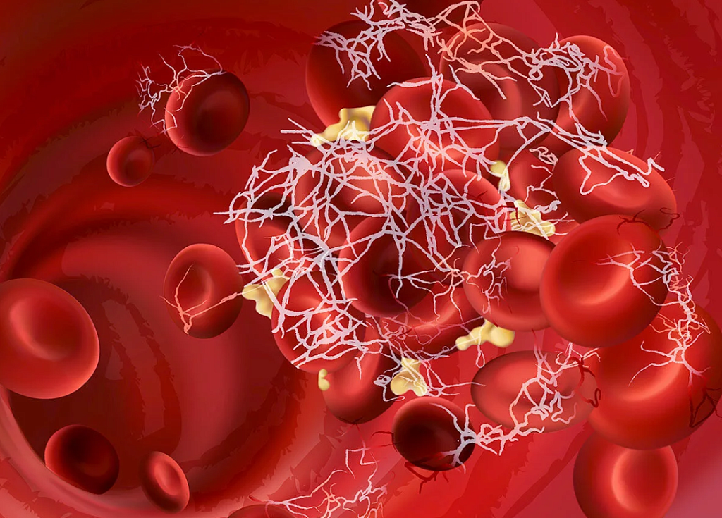 норма фибриногена в крови
